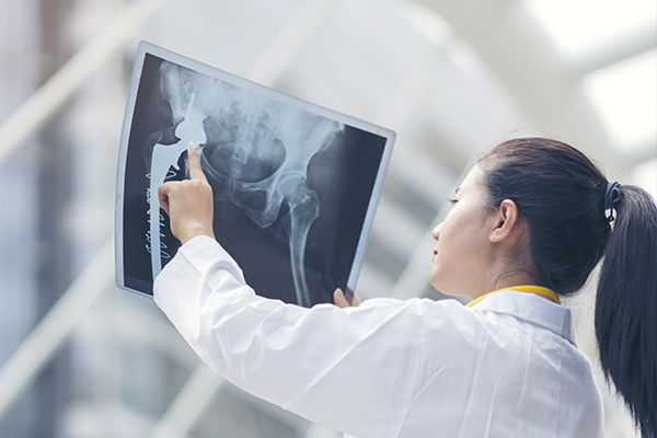 Go Up And Up to Know More About Bone Cancer