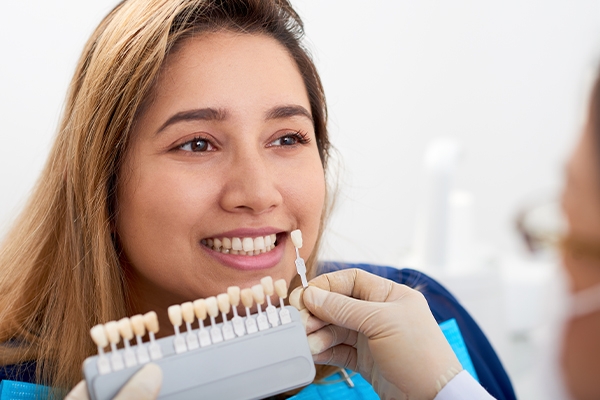 Membuka Rahasia Senyum Sempurna: Direct Veneer dan Indirect Veneer