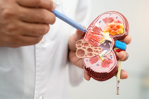 Top Diet Tips For People With Chronic Kidney Disease