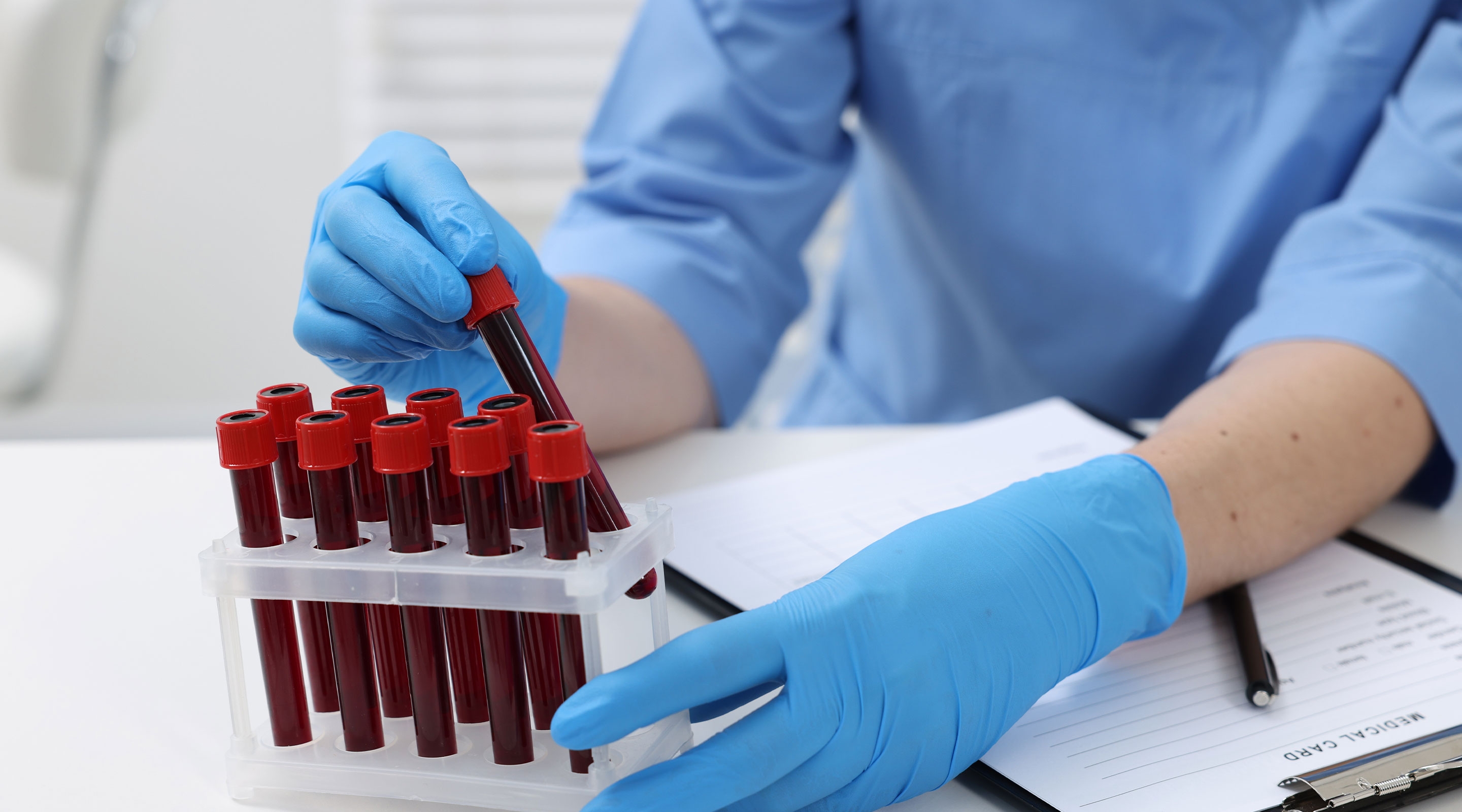 Pengambilan darah dilakukan H-7 penyuntikan immunotherapy.