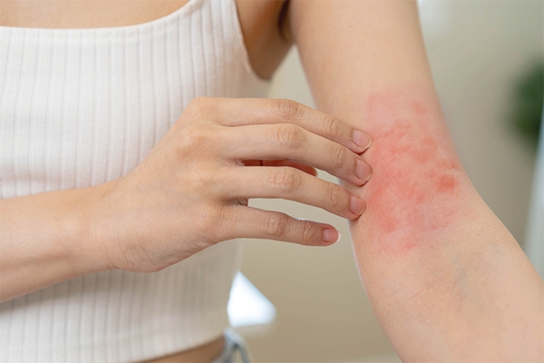 About 30% of people with diabetes experience skin disorders.