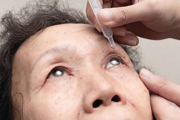 Smoking speed up the development of cataracts.