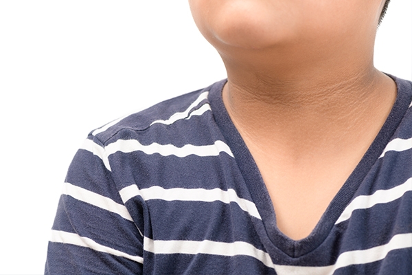 Dark and velvety skin are often associated with insulin resistance.