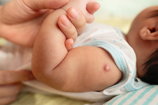 The BCG immunization is used to protect your child from Tuberculosi.