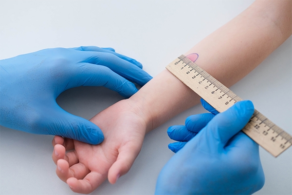 The Mantoux test is one way to diagnose TB in children.